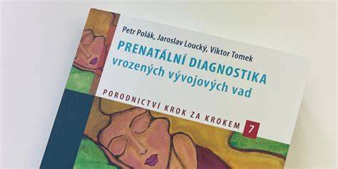 krok za krokem diagnostika startu (obrazek)